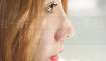 蜜桃社 – 杏子的迷幻温柔：一组美图合集让你忍不住眨眼